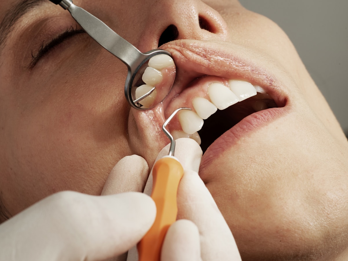 Adult Invisalign airway treatment
